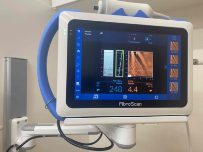 FibroScan（フィブロスキャン）